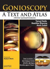 Gonioscopy: A Text and Atlas (with Goniovideos)