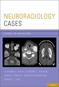 Neuroradiology Cases
