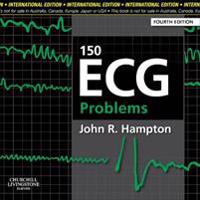 150 ECG PROBLEMS INTERNATIONAL EDITION