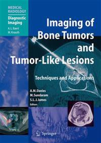 Imaging of Bone Tumors and Tumor-like Lesions