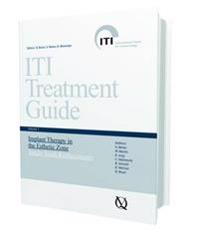Iti Treatment Guide Vol 1: Implant Therapy in the Esthetic Zone: Single-Tooth Replacements