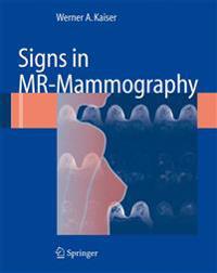Signs in MR-mammography