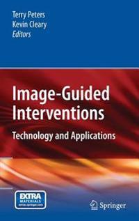 Image-guided Interventions