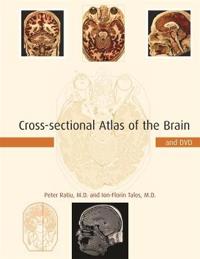 Cross-Sectional Atlas Of The Brain