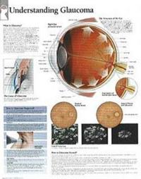 Understanding Glaucoma