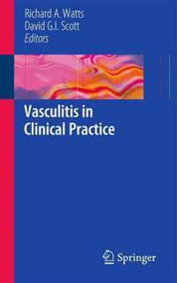 Vasculitis in Clinical Practice