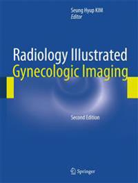 Radiology Illustrated: Gynecologic Imaging