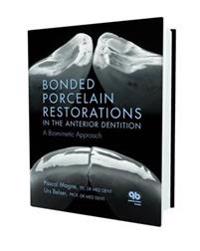 Bonded Porcelain Restorations in the Anterior Dentition