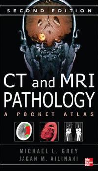 CT & MRI Pathology: a Pocket Atlas