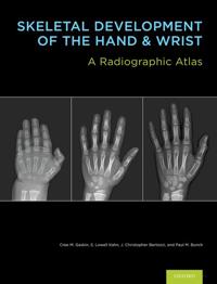 Skeletal Development of the Hand and Wrist