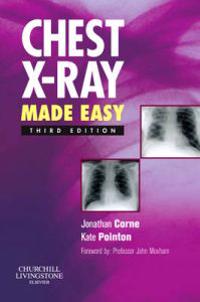 Chest X-Ray Made Easy