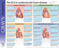 Understanding the ECG