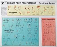 Trigger Point Pain Patterns Wall Charts