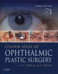 Colour Atlas of Ophthalmic Plastic Surgery with DVD