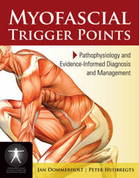 Myofascial Trigger Points