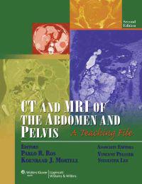CT and MRI of the Abdomen and Pelvis