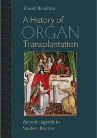 A History of Organ Transplantation