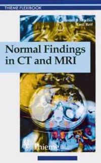 Normal Findings in CT and MRI