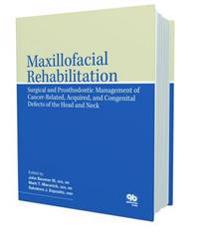 Maxillofacial Rehabilitation