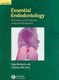 Essential Endodontology: Prevention and Treatment of Apical Periodontitis
