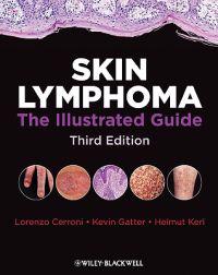 Skin Lymphoma: The Illustrated Guide