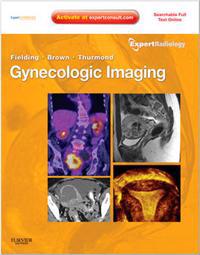 Gynecologic Imaging