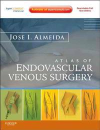 Atlas of Endovascular Venous Surgery