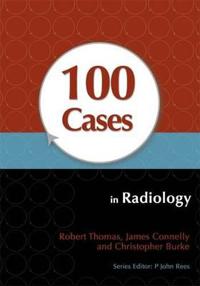 100 Cases in Radiology