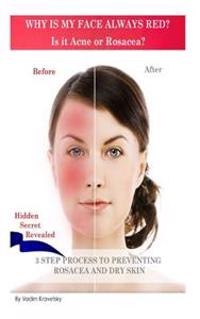 Why Is My Face Always Red? Is It Acne or Rosacea?: 3 Step Process to Preventing Rosacea and Dry Skin