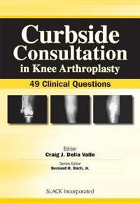 Curbside Consultation in Knee Arthroplasty