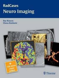 Neuro Imaging