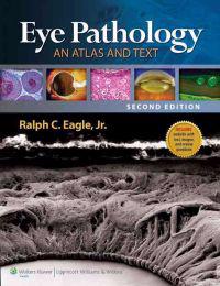 Eye Pathology: An Atlas and Text