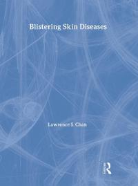 Blistering Skin Diseases