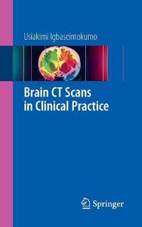 Brain CT Scans in Clinical Practice