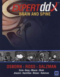 EXPERTddx : Brain and Spine