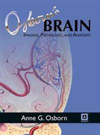 Osborn's Brain: Imaging, Pathology, and Anatomy
