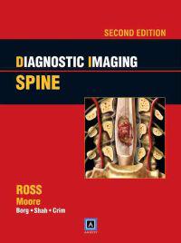 Diagnostic Imaging: Spine