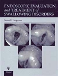 Endoscopic Evaluation and Treatment of Swallowing Disorders