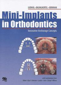 Mini-Implants in Orthodontics: Innovative Anchorage Concepts