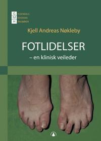 Fotlidelser; en klinisk veileder