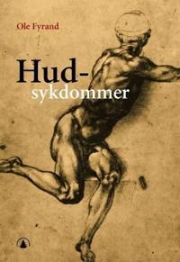 Hudsykdommer; diagnose, pleie og behandling