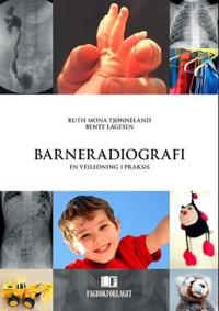 Barneradiografi; en veiledning i praksis