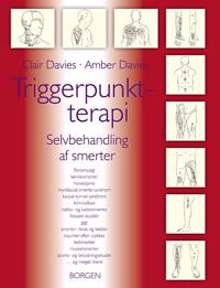 Triggerpunktterapi