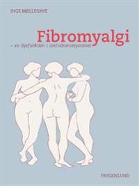 Fibromyalgi