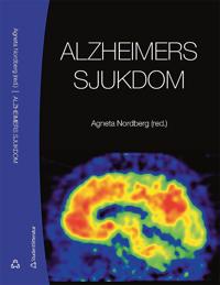 Alzheimers sjukdom