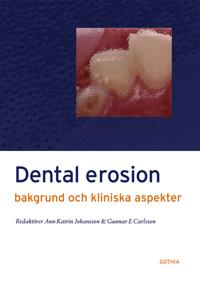 Dental erosion : bakgrund och kliniska aspekter