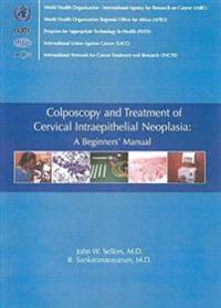 Colposcopy and Treatment of Cervical Intraepithelial Neoplasia