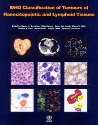 WHO Classification of Tumours of Haematopoietic and Lymphoid Tissues