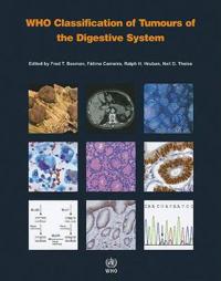 WHO Classification of Tumours of the Digestive System