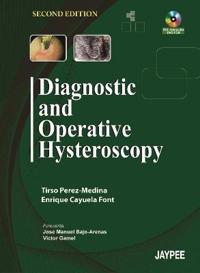 Diagnostic and Operative Hysteroscopy